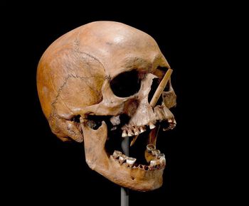 Mange skjeletter fra steinalderen bærer spor av vold. Dette kraniet ble&amp;#160;funnet med en gjennomborende pilspiss.&amp;#160;Les mer&amp;#160;om vold i steinalderen . Foto: Roberto Fortuna &amp;#38; Kira Ursem/Nationalmuseet, København