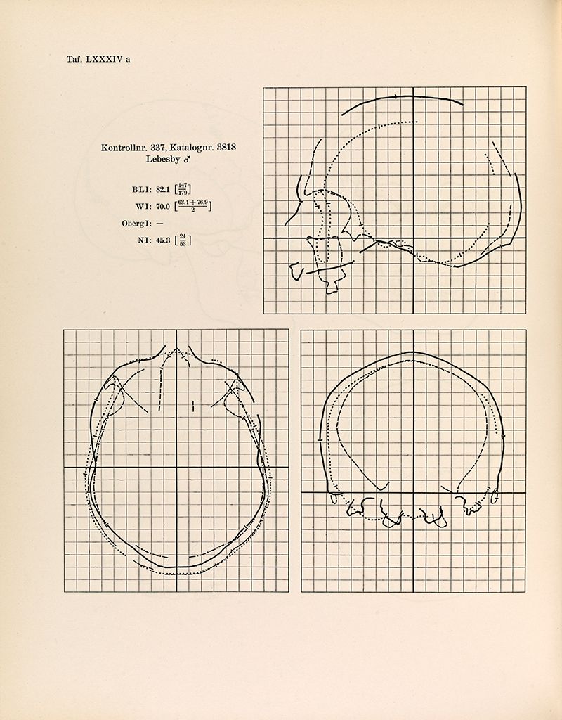 Fotografi av ruteark som viser størrelsen på hodeskalle, ulike vinkler